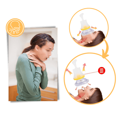 AirwayClear™ Anti-Choking Device - AirwayClear - Anti Choking Device